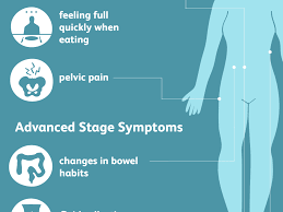 Certain symptoms, such as bloating and pelvic pain, are commonly caused by a number of conditions. Ovarian Cancer Signs Symptoms And Complications