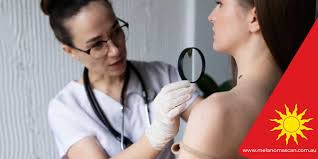 Image result for Self Skin Exam