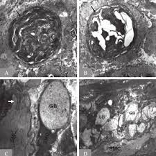 Although the sarcolemma is similar to other cell membranes, it has other functions that set it apart. Transmission Electron Microscopy Examination Of Smooth Muscle Cells In Download Scientific Diagram