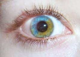 Blue And Yellow Fgreen Heterochromia Gozler Cizimler Beautiful
