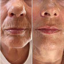 Código de Barras | Medicina Estética | Clínicas Barber