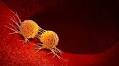 GI Cell partners with Japan's Optieum Biotechnologies to commercialize CAR-NK cell products