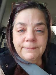 Simba" is about to undergo Gastrointestinal surgery. Say a prayer for him  🙏😺