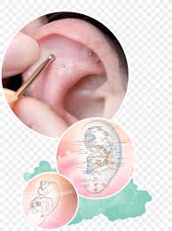 auriculotherapy acupuncture auricle ear png 1000x1341px