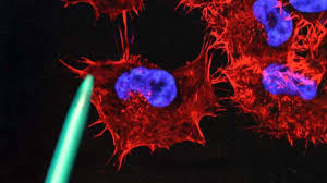 14 beliebte wann ist krebs heilbar im vergleich 07/2021 🐹 das sagen die verbraucher! Wird Krebs In Wenigen Jahren Tatsachlich Komplett Besiegbar Sein Gesundheit