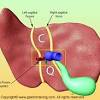Diagram human body liver, diagram human colon, diagram human digestive system, diagram human heart, diagram human kidney, diagram human lungs, diagram human stomach, structure of human liver, inner related posts of 3d diagram of human liver. 1