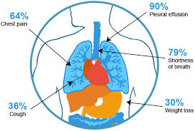 It's estimated that 3,000 of those, approximately 80% are diagnosed with malignant pleural mesothelioma (mpm). Mesothelioma Cancer Microbe Notes