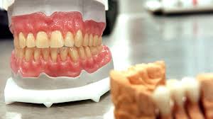 Check spelling or type a new query. Lost Dentures Cost Patients Dignity And Nhs 1m News The Times