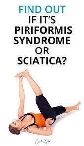 Eatingtipsforgoodhealth Piriformis Syndrome Piriformis Muscle Piriformis
