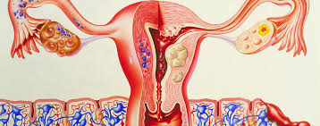 Wo kann eine endometriose auftreten? Endometriumkarzinom Focus Arztsuche