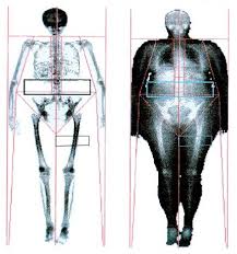 Image result for full body scan
