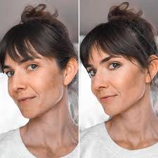 Minimal makeup for melasma coverage tips