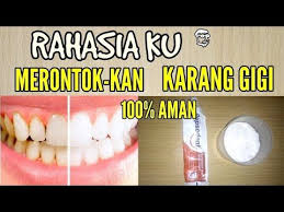 Cara Menghilangkan Karang Gigi Plak Gigi Dan Gigi Kuning Putih Kembali Sehat Itu Murah Youtube Kesehatan Gigi Perawatan Kulit Pemutih Gigi