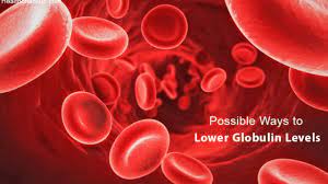 How To Lower Globulin Levels Naturally | Side Effects Of High, Low Globulin