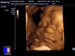 Compra geles para ultrasonidos a precios bajos en amazon.es. Ultrasonido Juarez Consultorio Medico Y Ultrasonido Home Facebook