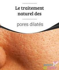 Traitement Naturel Les Pores Dilates Eliminez Les Une Bonne Fois Pour Toutes Acne Traitement Naturel Acne Traitement Pores Dilates