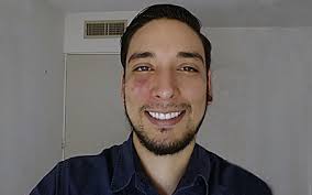 Alumno investigador de la Unison fabrica prototipos de injertos vasculares 