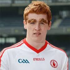 Bushy Eyebrow Epidemic Threatens To Scupper Tyrone's Title Defence