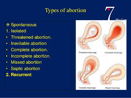 We did not find results for: Pdf Telecharger Bleeding In Early Pregnancy Gratuit Pdf Pdfprof Com