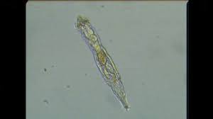 Viktor hovland (18 eylül 1997 doğumlu) pga tour'da oynayan norveçli profesyonel bir golfçüdür. Inhabited By Rotifers Frozen For 24 000 Years In Siberian Permafrost Industry Update Com