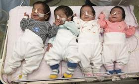 Auch schall für technische anwendung im frequenzbereich über etwa 1 khz, der nicht zum hören bestimmt ist. Eineiige Oder Zweieiige Zwillinge Seite 2 Babywelten Ch