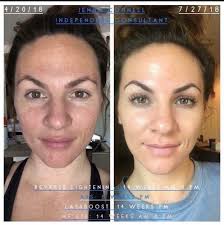 Don't wait until your face becomes the problem — start caring before the  signs show. Keep your skin firm, smooth, and youthful with Zenith — because  prevention always looks better than cure.