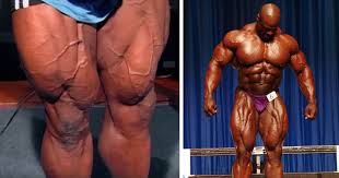 Must contain at least 4 different symbols; So Trainierte Ronnie Coleman In Seiner Blutezeit Die Beine Gannikus De