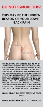 There are things you can do to treat and prevent them and in most cases you will not need to a see a gp for. 13 Pilonidal Cyst Ideas Pilonidal Cyst Cysts Rectal