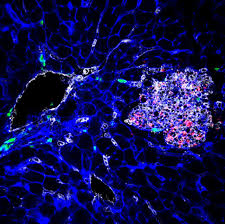 Listeria has been found in at least 42 species of wild and domesticated animals, and 17 species of birds. How Dormant Listeria Hides In Cells