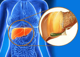 Check spelling or type a new query. Cat Traiesti Cu Ciroza Hepatica Despre ViaÈa Din Romania