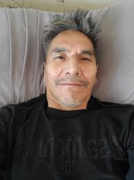 Evening “ Whistlers “ Around The Globe I Hope You Are All Well I suffer a  lifelong disease caused at both that causes me to be paralysed at the leg  area and