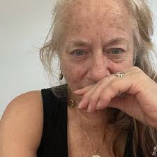 I'm so sorry 😞 get those snuggles in! I had a dog in my teens that was hit  by a car and broke his jaw. He had his jaw wired shut to