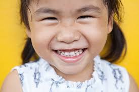 Is A Dental Crown Necessary For A Baby Tooth Bramoton On Dentist