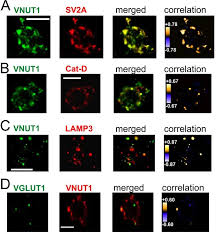 Image result for svrab na k%u016F%u017Ei