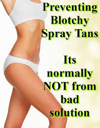 What Causes A Blotchy Spray Tan Tampa Bay Tan