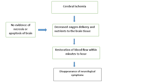 Image result for Stroke Pathophysiology