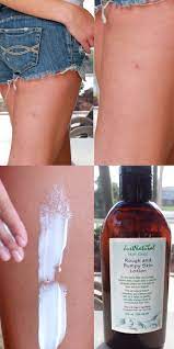 Rough And Bumpy Smoothing Skin Lotion I Ve Been Using This Lotion For About A Month Now On My Elbows And Leg Beauty Hacks Beauty Skin Health And Beauty Tips