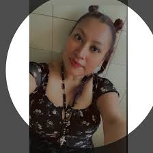 Are green olives safe to eat after bariatric surgery?