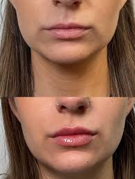 Jade Alexandra Concepcion (@enfermerajade) • Instagram photos and videos