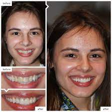 Dentists manage our oral health, from making recommendations for achieving the best oral hygiene to diagnosing and treating issues with our teeth and gums. Cosmetic Dentistry Soho Smile