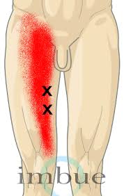Pin On Body Moves To The Point