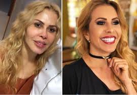 Maybe you would like to learn more about one of these? Plastica Dos Famosos Fotos Antes E Depois Das Celebridades