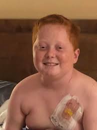 Blake is all done with the chemo and got his feeding tube out and now he  will be going to University of Iowa for an MRI and other tests to see how