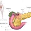 A primary liver cancer is uncommon; 3