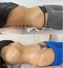 Brazilian Lymphatic Drainage Full Body Training – BODYRITE CONTOUR