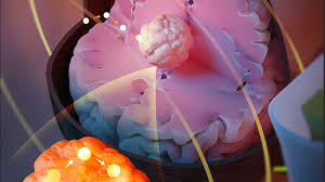 Remotely heated, magnetically-guided hot seeds could be used to burn out  brain tumours