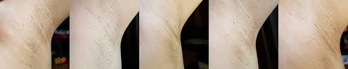 Meet our most powerful hair removal system for permanent hair reduction that you can achieve at home. Remington Ilight Ultra An Honest Review Before After Pics