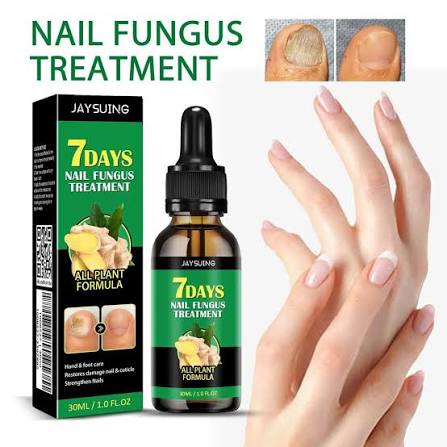 Liquido para hongos en las uñas Jaysuing 7Days de 30 ml con fórmula de  jengibre* Uso: Está diseñado para combatir la onicomicosis (infección por  hongos), reducir la decoloración amarillenta y fortalecer las