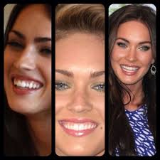 Before and after megan fox:… Megan Fox Before After Veneers Perfect Smile Plastic Surgery Hair Beauty