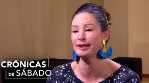 Check spelling or type a new query. Natalia Ponce De Leon Recuerda Lo Que Sintio Al Ser Atacada Con Acido Sulfurico Youtube